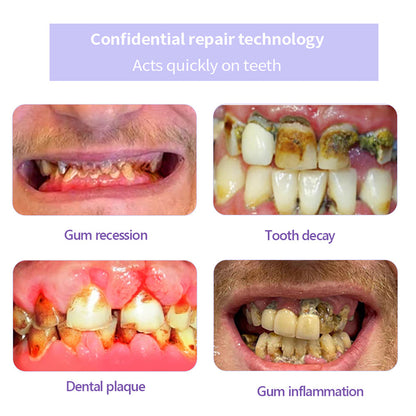 ODALIT™ TeethRestoration Mineral Powder🦷Obtain American Dental Association (ADA) Certification (Treats periodontitis and mouth ulcers, prevents tooth loss, and repairs gum recession）