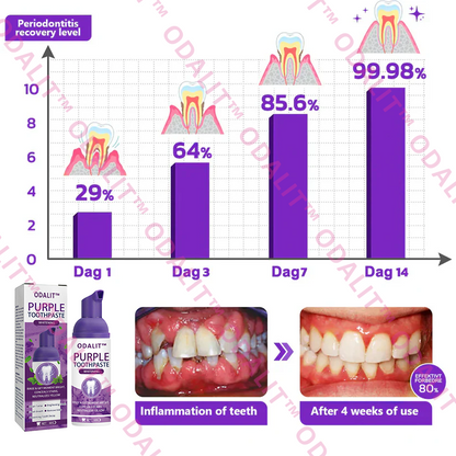 ODALIT™ Purple Whitening Toothpaste🦷(ADA recommended)