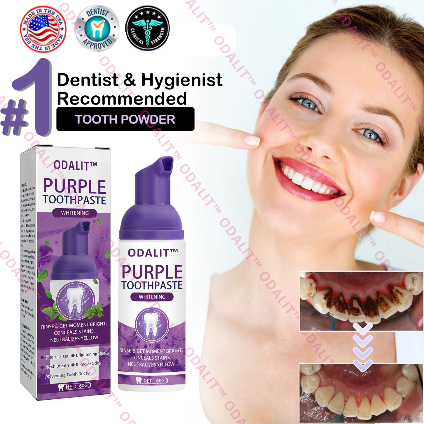 ODALIT™ Purple Whitening Toothpaste🦷(ADA recommended)